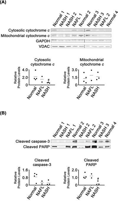 https://cdn.ncbi.nlm.nih.gov/pmc/blobs/ef35/5609929/5200725a1497/oncotarget-08-63370-g004.jpg