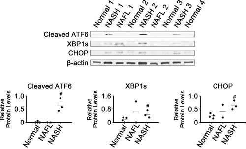 https://cdn.ncbi.nlm.nih.gov/pmc/blobs/ef35/5609929/57f5b523042d/oncotarget-08-63370-g001.jpg
