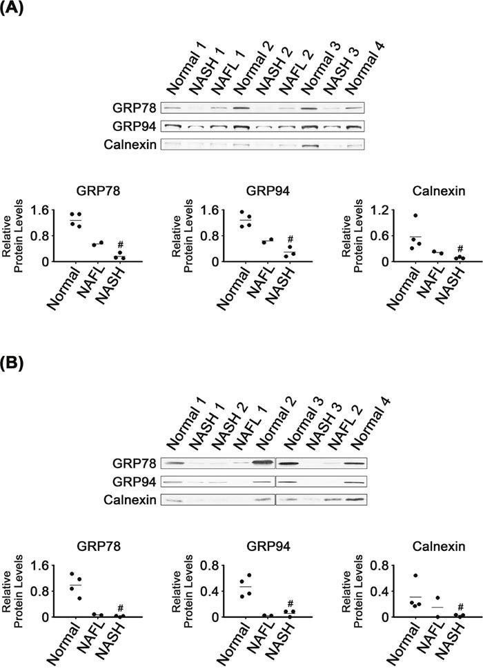 https://cdn.ncbi.nlm.nih.gov/pmc/blobs/ef35/5609929/5920840aa1f5/oncotarget-08-63370-g002.jpg