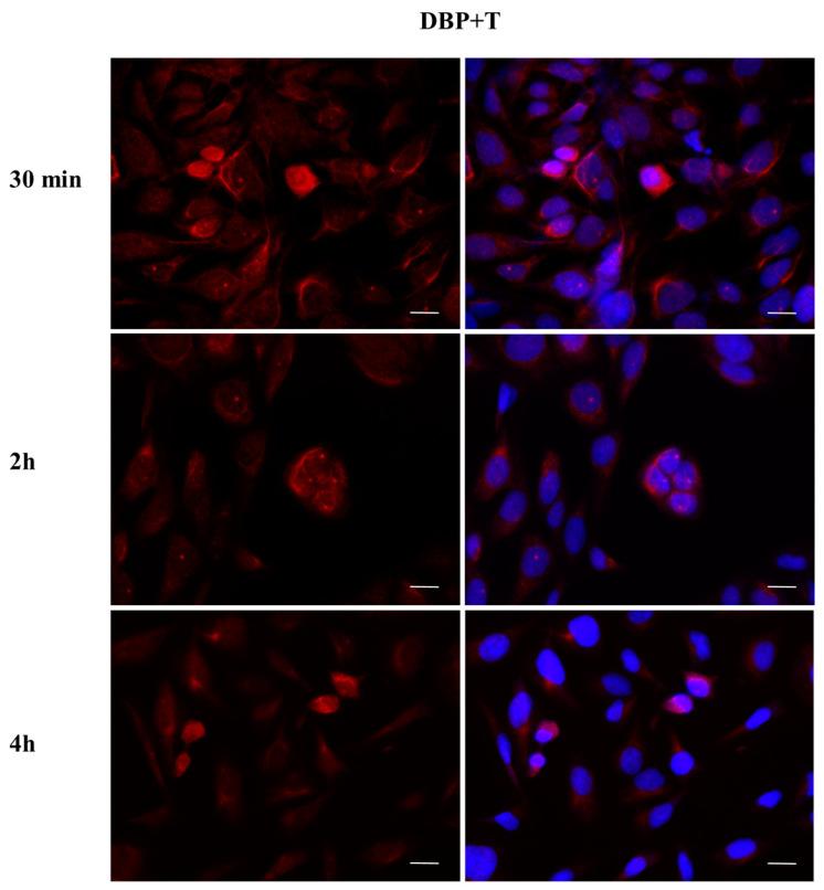 https://cdn.ncbi.nlm.nih.gov/pmc/blobs/ef36/10531810/5582b7cb888f/ijms-24-14341-g011.jpg