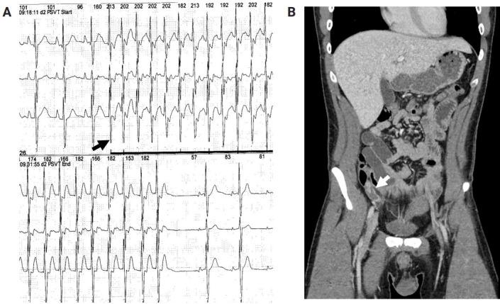 https://cdn.ncbi.nlm.nih.gov/pmc/blobs/ef37/10295918/84d5b31cd160/encephalitis-2021-00185f3.jpg