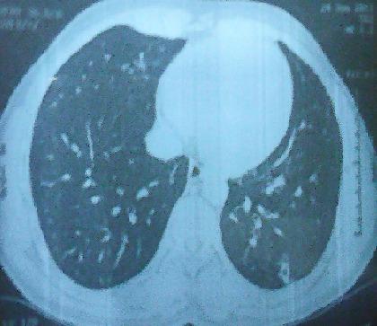 https://cdn.ncbi.nlm.nih.gov/pmc/blobs/ef3c/4537915/2e2448c2c174/PAMJ-20-449-g002.jpg