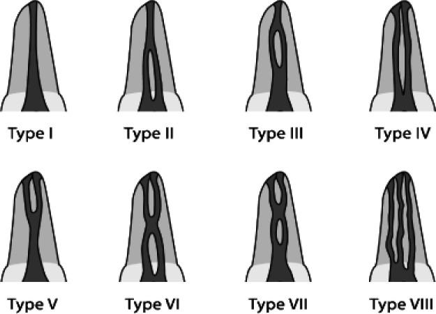 https://cdn.ncbi.nlm.nih.gov/pmc/blobs/ef3f/9923410/fe0fcafa30d0/IEJ-14-283-g001.jpg