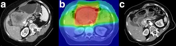 https://cdn.ncbi.nlm.nih.gov/pmc/blobs/ef42/3338091/6a473ef4a4b1/1748-717X-7-28-1.jpg