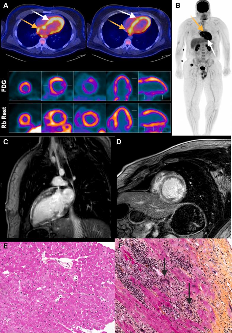 https://cdn.ncbi.nlm.nih.gov/pmc/blobs/ef48/12402352/defda7f18d72/gr2.jpg