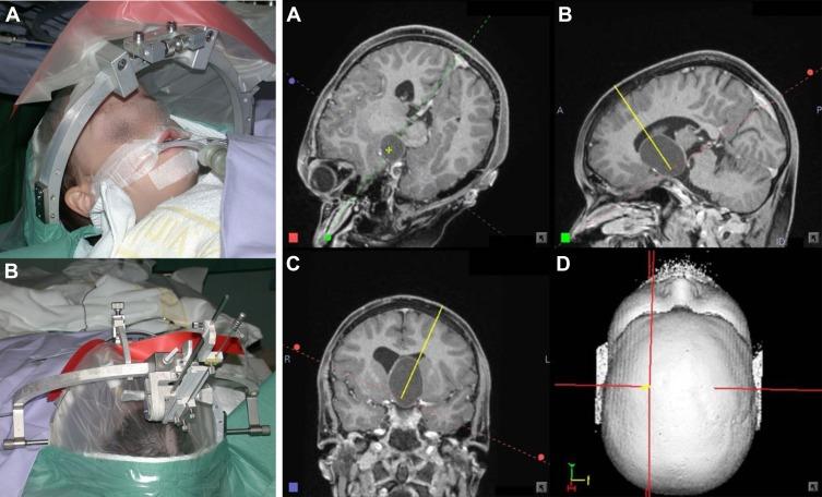 https://cdn.ncbi.nlm.nih.gov/pmc/blobs/ef49/7090177/30ff36429e79/RSRR-7-1-g0012.jpg