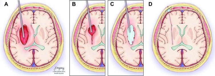 https://cdn.ncbi.nlm.nih.gov/pmc/blobs/ef49/7090177/a939fbdb6049/RSRR-7-1-g0017.jpg