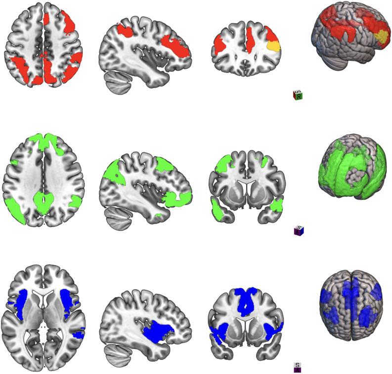 https://cdn.ncbi.nlm.nih.gov/pmc/blobs/ef51/9608772/c6ec1674cedb/fnhum-16-1026639-g0001.jpg