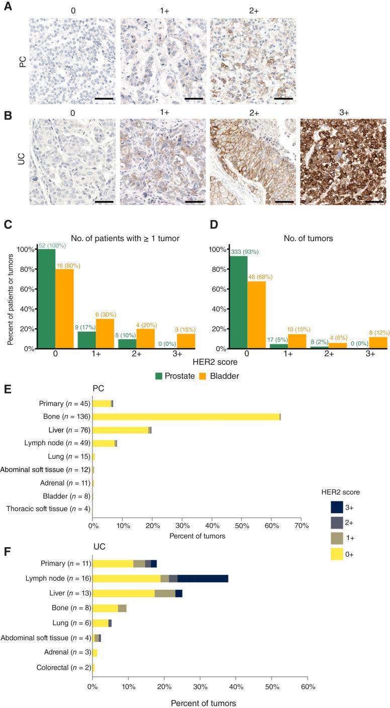 https://cdn.ncbi.nlm.nih.gov/pmc/blobs/ef58/12375912/bbd423d5529c/crc-25-0069_f1.jpg