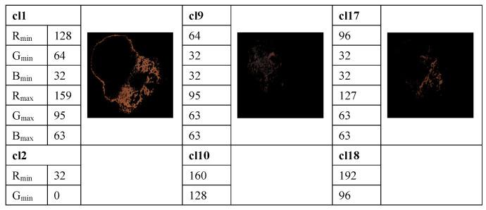 https://cdn.ncbi.nlm.nih.gov/pmc/blobs/ef59/8582408/aa673efb85fe/cancers-13-05256-g003a.jpg