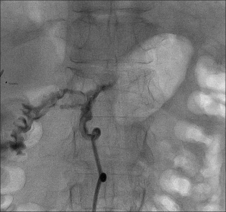 https://cdn.ncbi.nlm.nih.gov/pmc/blobs/ef5f/4304493/e6f02fecbcde/kjhbps-17-75-g002.jpg