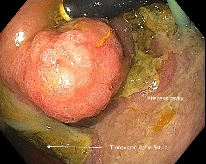 https://cdn.ncbi.nlm.nih.gov/pmc/blobs/ef64/6890960/f04e86818511/gr2.jpg