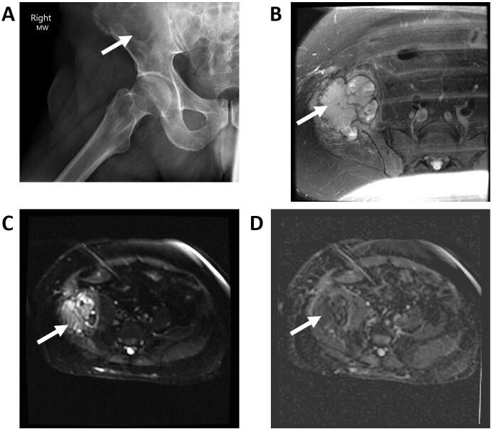 https://cdn.ncbi.nlm.nih.gov/pmc/blobs/ef66/9667480/b6198cde329d/bjro.20210077.g006.jpg