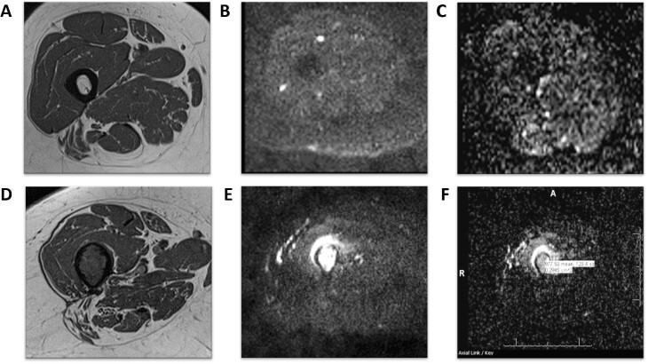 https://cdn.ncbi.nlm.nih.gov/pmc/blobs/ef66/9667480/e4807054f034/bjro.20210077.g004.jpg