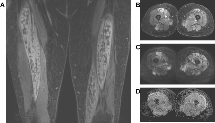 https://cdn.ncbi.nlm.nih.gov/pmc/blobs/ef66/9667480/eb31ec0c0040/bjro.20210077.g017.jpg