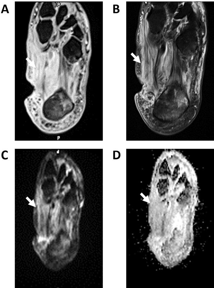 https://cdn.ncbi.nlm.nih.gov/pmc/blobs/ef66/9667480/ece779734a1d/bjro.20210077.g014.jpg