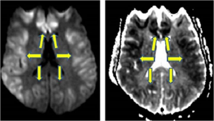 https://cdn.ncbi.nlm.nih.gov/pmc/blobs/ef6f/6231053/0f5e4c68bc2d/gr9.jpg