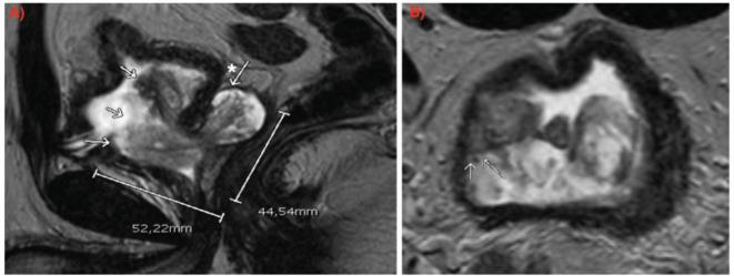 https://cdn.ncbi.nlm.nih.gov/pmc/blobs/ef73/12185863/5d62bf622938/can-19-1913fig1.jpg