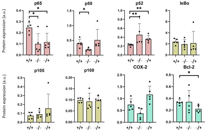 https://cdn.ncbi.nlm.nih.gov/pmc/blobs/ef74/10745731/98c98867f57b/nanomaterials-13-03166-g004.jpg