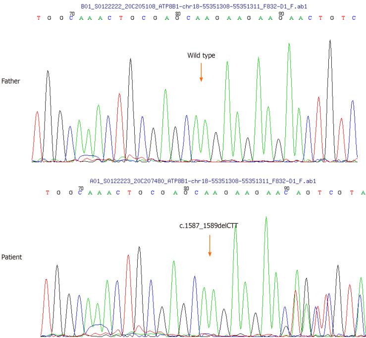https://cdn.ncbi.nlm.nih.gov/pmc/blobs/ef76/11235557/782c746ab652/WJCC-12-4427-g002.jpg