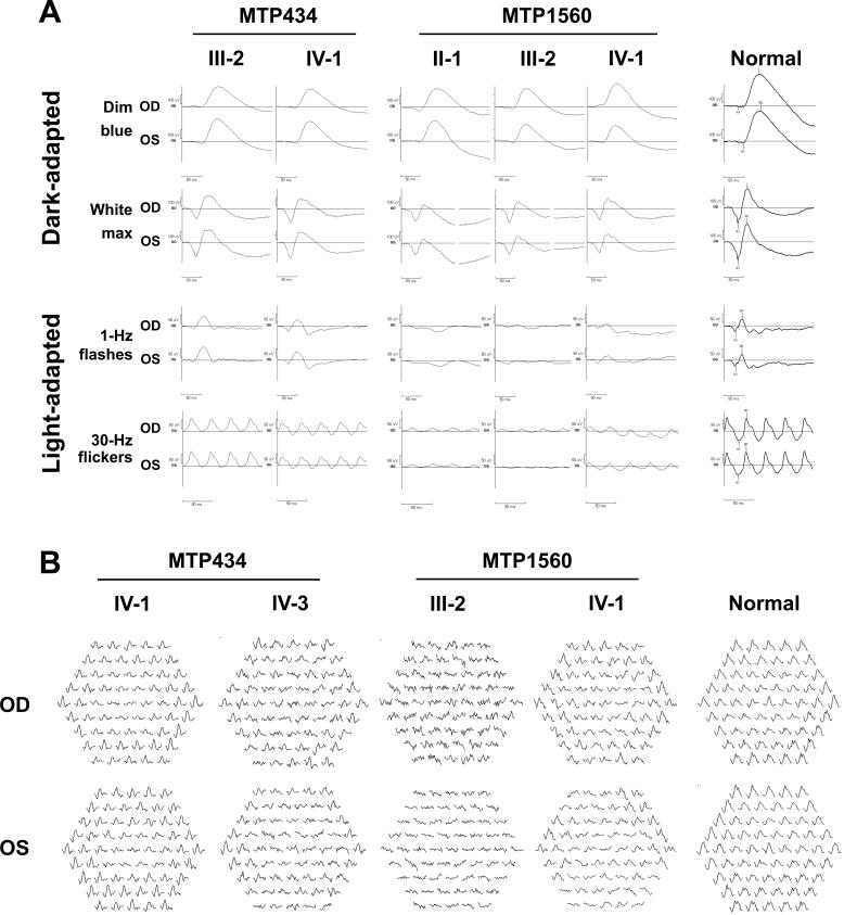 https://cdn.ncbi.nlm.nih.gov/pmc/blobs/ef7a/5389339/5cd865c042ee/mv-v23-198-f5.jpg