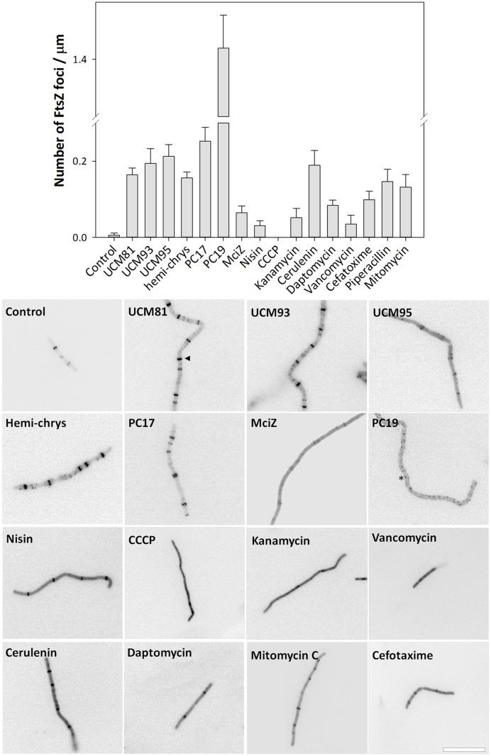https://cdn.ncbi.nlm.nih.gov/pmc/blobs/ef89/5045927/6762f2221206/fmicb-07-01558-g004.jpg