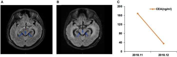 https://cdn.ncbi.nlm.nih.gov/pmc/blobs/ef8d/7066117/b146382ff38a/fonc-10-00224-g0002.jpg