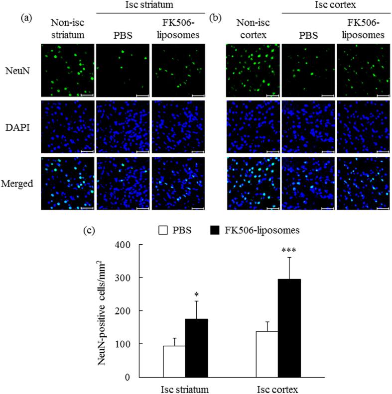 https://cdn.ncbi.nlm.nih.gov/pmc/blobs/ef90/4954989/ca13eaa36335/srep30127-f4.jpg