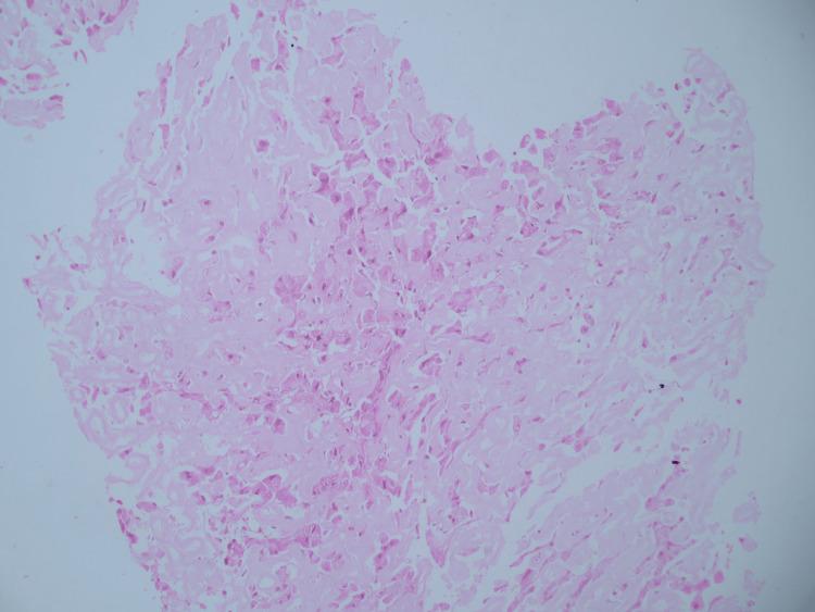 https://cdn.ncbi.nlm.nih.gov/pmc/blobs/ef91/11785456/70b94a59264d/cureus-0017-00000076719-i02.jpg