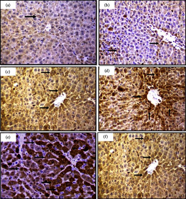 https://cdn.ncbi.nlm.nih.gov/pmc/blobs/ef9c/9925264/2d0251a89d1c/JT2023-2200539.003.jpg