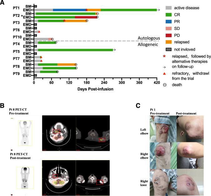https://cdn.ncbi.nlm.nih.gov/pmc/blobs/efa8/10125985/d119765f6316/41408_2023_822_Fig2_HTML.jpg