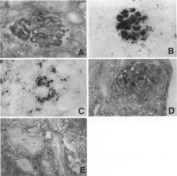 https://cdn.ncbi.nlm.nih.gov/pmc/blobs/efac/1870780/9ffeafb14ba0/amjpathol00049-0115-a.jpg
