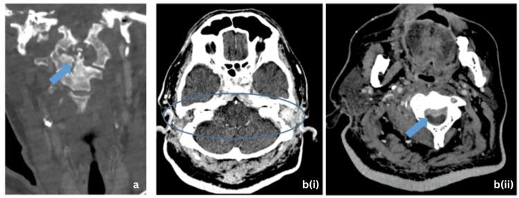 https://cdn.ncbi.nlm.nih.gov/pmc/blobs/efae/10853034/2532131a5ca7/cureus-0016-00000051973-i03.jpg