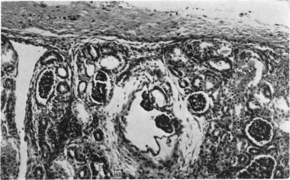 https://cdn.ncbi.nlm.nih.gov/pmc/blobs/efb5/2019442/fec1999b40af/archdisch01578-0005-b.jpg