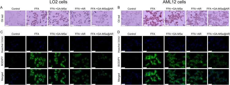 https://cdn.ncbi.nlm.nih.gov/pmc/blobs/efb9/12015739/1273b8a93e29/IJN-20-5017-g0006.jpg