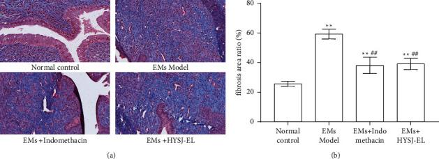 https://cdn.ncbi.nlm.nih.gov/pmc/blobs/efbe/9256397/9c18ff519948/ECAM2022-5256578.005.jpg
