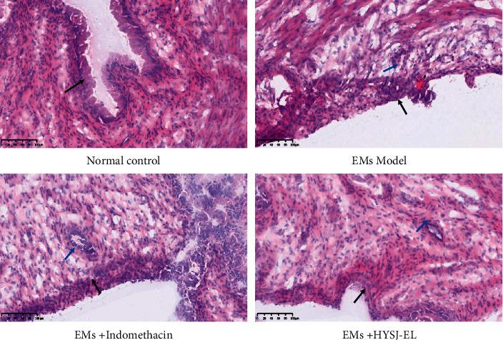 https://cdn.ncbi.nlm.nih.gov/pmc/blobs/efbe/9256397/ecb2f4c8cfd6/ECAM2022-5256578.003.jpg