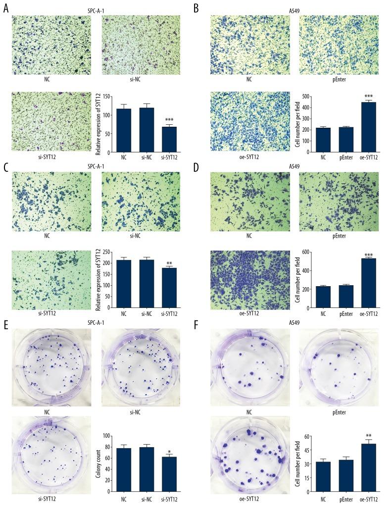https://cdn.ncbi.nlm.nih.gov/pmc/blobs/efc0/7063850/721500ca49c1/medscimonit-26-e920351-g003.jpg