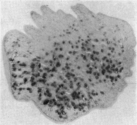 https://cdn.ncbi.nlm.nih.gov/pmc/blobs/efc2/510174/fd8fb7b1bf88/brjopthal00410-0061-a.jpg
