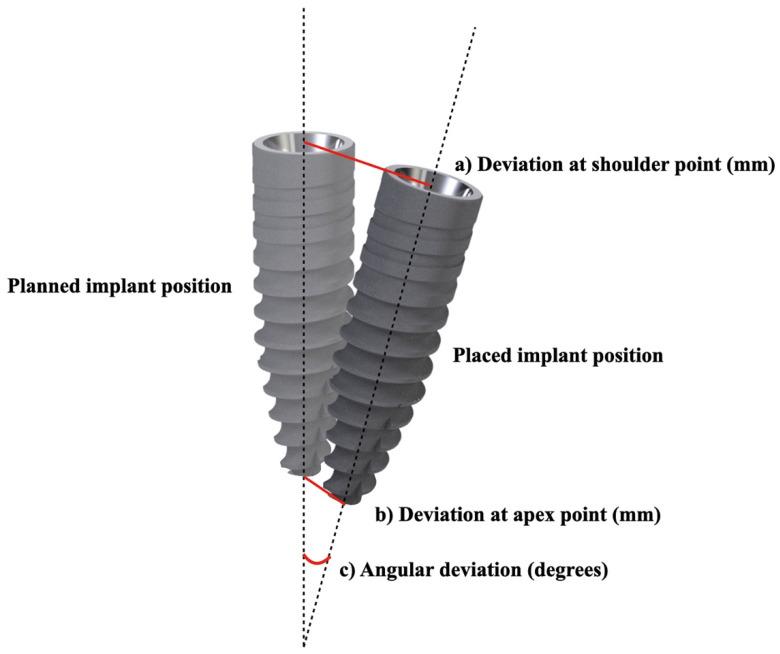 https://cdn.ncbi.nlm.nih.gov/pmc/blobs/efc2/8880344/a1dc0199c9c4/materials-15-01462-g001.jpg