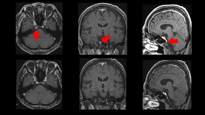 https://cdn.ncbi.nlm.nih.gov/pmc/blobs/efc3/7593206/db4eff7d71d4/cureus-0012-00000010692-i05.jpg