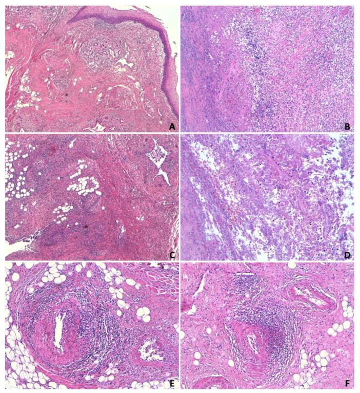 https://cdn.ncbi.nlm.nih.gov/pmc/blobs/efca/11396599/9f3f2ba6b417/jcm-13-05198-g003.jpg