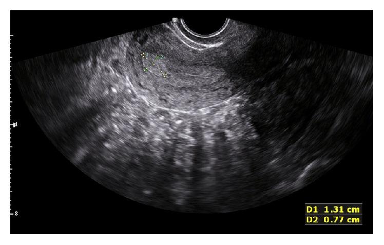 https://cdn.ncbi.nlm.nih.gov/pmc/blobs/efd0/5143713/1a79d42b0d1b/OGI2016-3561324.001.jpg