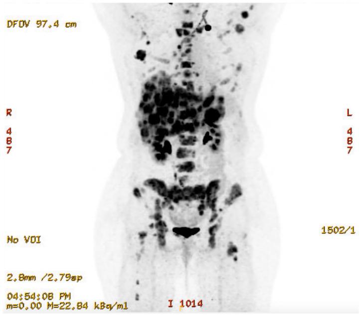 https://cdn.ncbi.nlm.nih.gov/pmc/blobs/efd1/12026433/cdbee8acc4a3/curroncol-32-00205-sch007.jpg