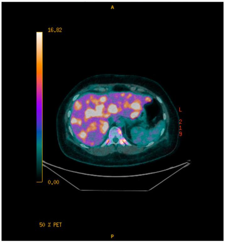 https://cdn.ncbi.nlm.nih.gov/pmc/blobs/efd1/12026433/f60a1d3bb0e5/curroncol-32-00205-sch005.jpg