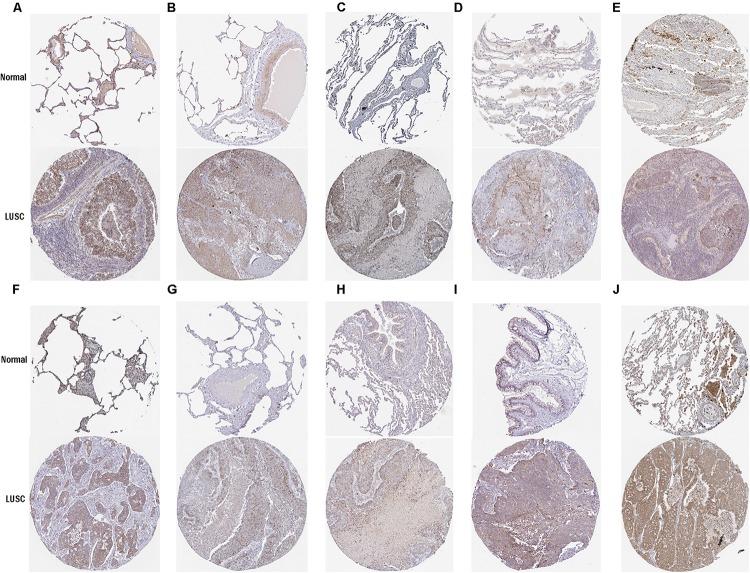 https://cdn.ncbi.nlm.nih.gov/pmc/blobs/efd1/7066120/ef110142a49e/fgene-11-00185-g003.jpg