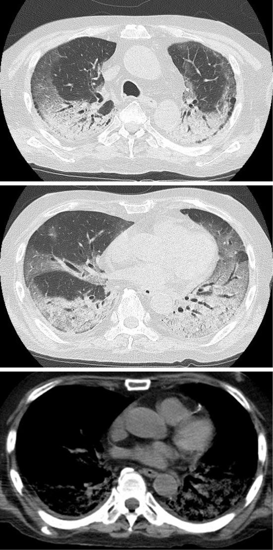 https://cdn.ncbi.nlm.nih.gov/pmc/blobs/efe8/11157320/d13116b9b50a/1349-7235-63-1459-g001.jpg