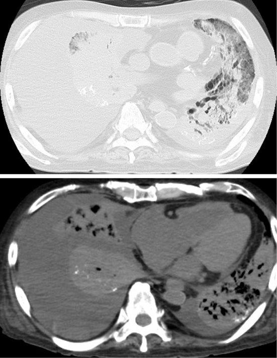 https://cdn.ncbi.nlm.nih.gov/pmc/blobs/efe8/11157320/d6eedff65e35/1349-7235-63-1459-g003.jpg