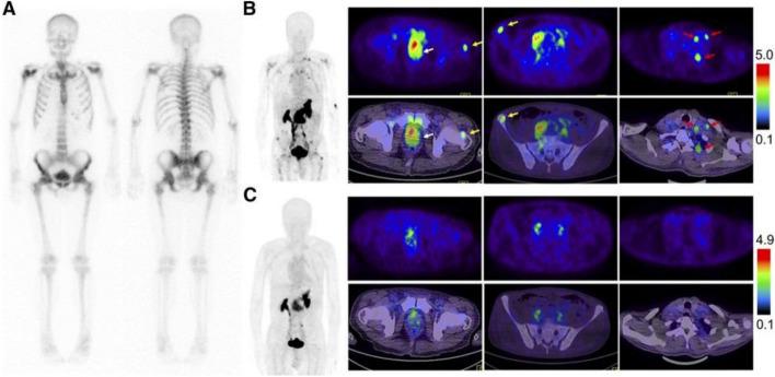 https://cdn.ncbi.nlm.nih.gov/pmc/blobs/efec/10811881/de28518105b8/40644_2024_658_Fig4_HTML.jpg