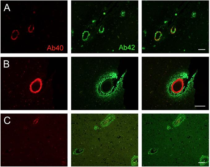 https://cdn.ncbi.nlm.nih.gov/pmc/blobs/eff2/7885797/cfef5518f81c/TRC2-7-e12145-g001.jpg